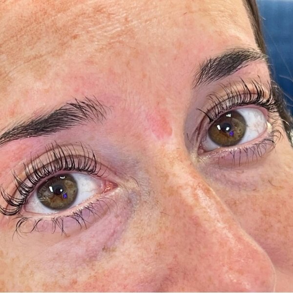 2 sky-blue-sthetic-centro-estetico-tratamientos-faciales-corporales-microblading-depilacion-neuromodulacion-indiba-mirasierra-madrid