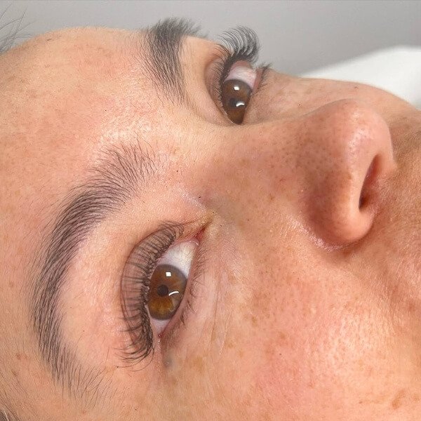 4 sky-blue-sthetic-centro-estetico-tratamientos-faciales-corporales-microblading-depilacion-neuromodulacion-indiba-mirasierra-madrid