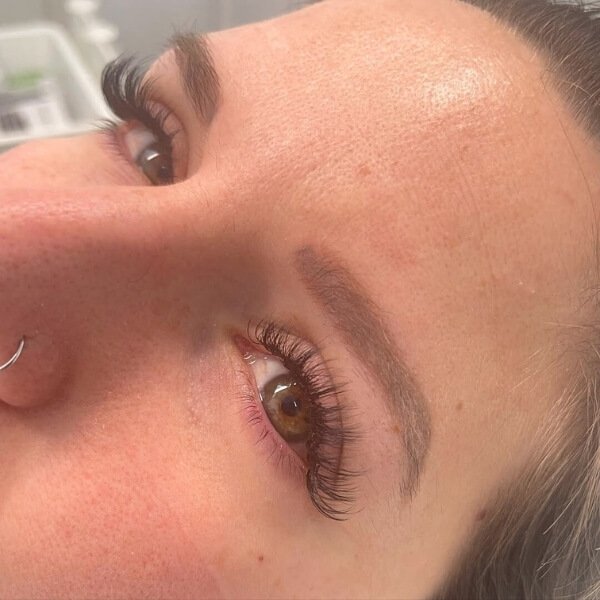 6 sky-blue-sthetic-centro-estetico-tratamientos-faciales-corporales-microblading-depilacion-neuromodulacion-indiba-mirasierra-madrid